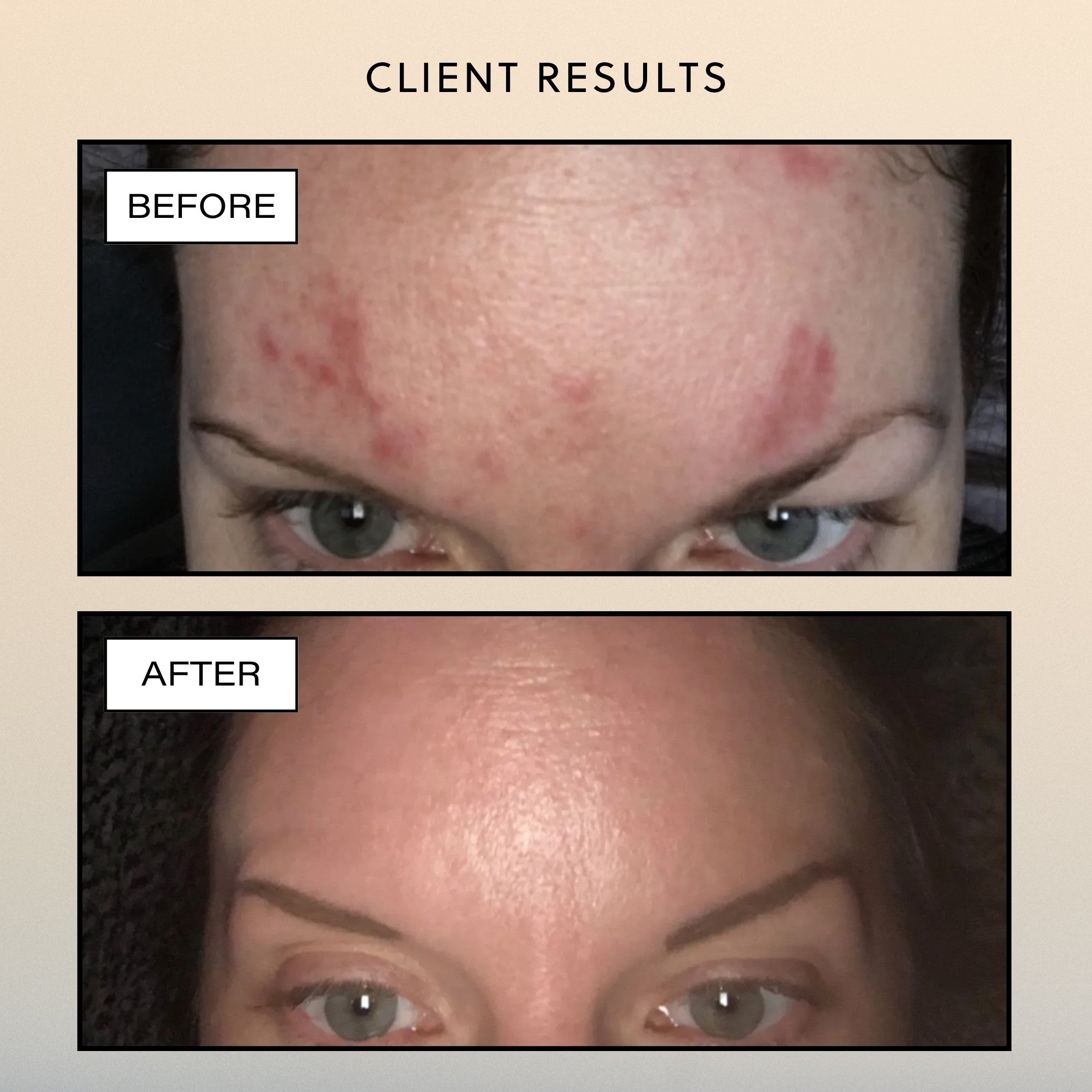 Botanical Recovery Serum